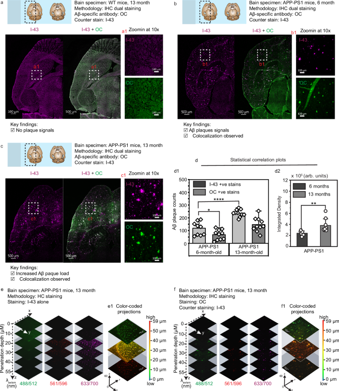 Fig. 5: Immunohistochemistry staining and quantitative analysis of amyloid plaque burden in APP-PS1 mice vs WT.