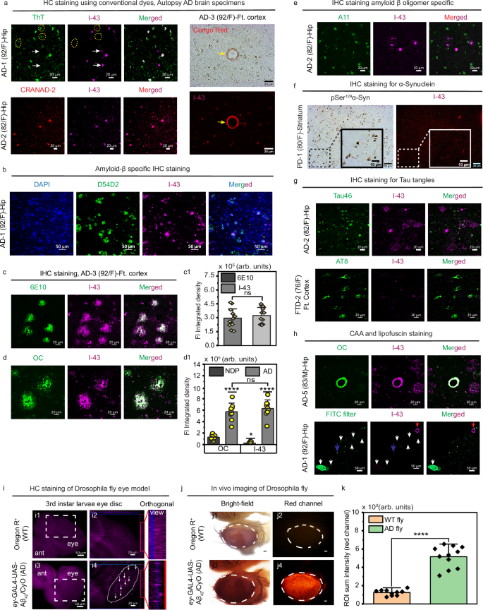 Fig. 7: Confocal imaging of postmortem brain tissues from AD, FTD, and PD patients upon treatment with I-43.