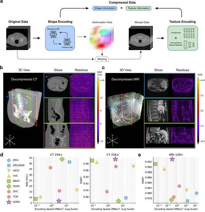 Fig. 1: The schematic of DeepSTD and its compression performance on the CT and MRI data.