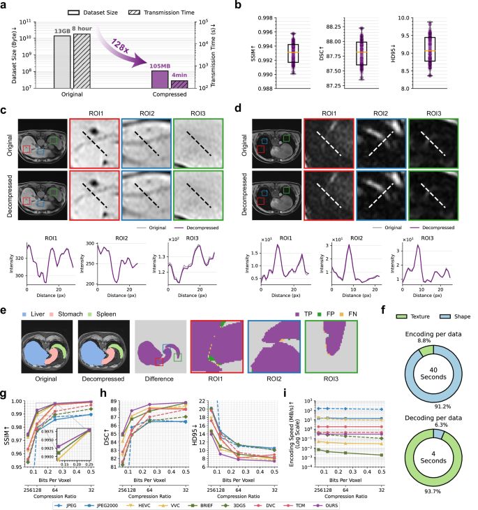 Fig. 3: DeepSTD achieved high efficiency MRI data compression, demonstrated on the Amos dataset50.