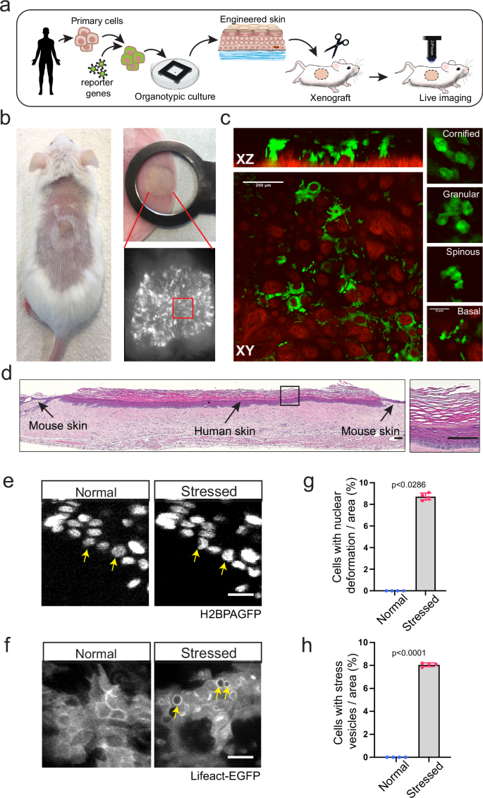 Fig. 6: Formation of stress vesicles in a human skin xenograft.