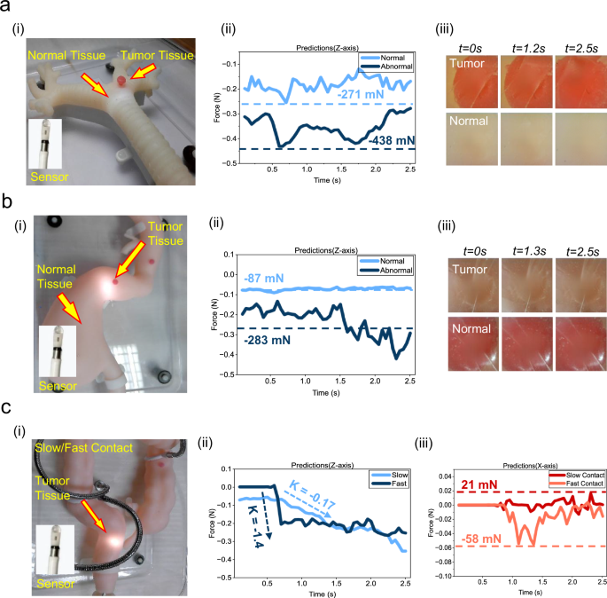 Fig. 4: In vitro contact experiment simulating human organ model.