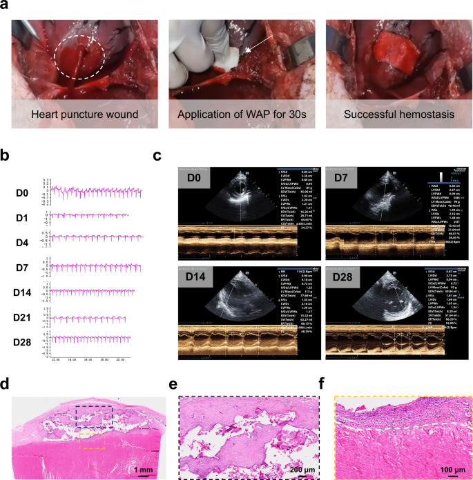 Fig. 4: WAP effectively achieves hemostasis following cardiac puncture and facilitates wound repair.