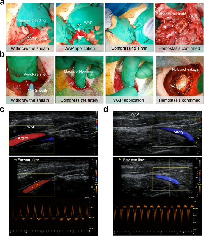 Fig. 5: WAP effectively achieves hemostasis following artery puncture and facilitates wound repair.