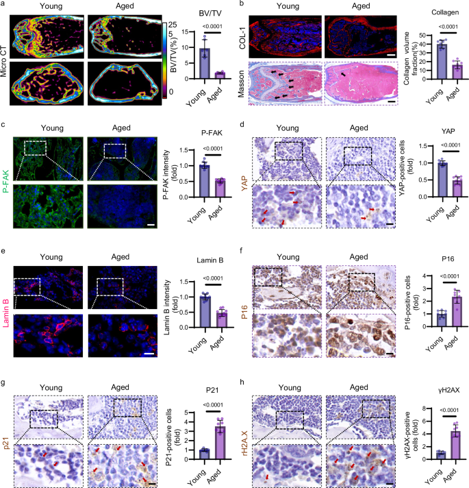 Fig. 3: Age-associated decline in cellular mechanotransduction within bone marrow tissue.