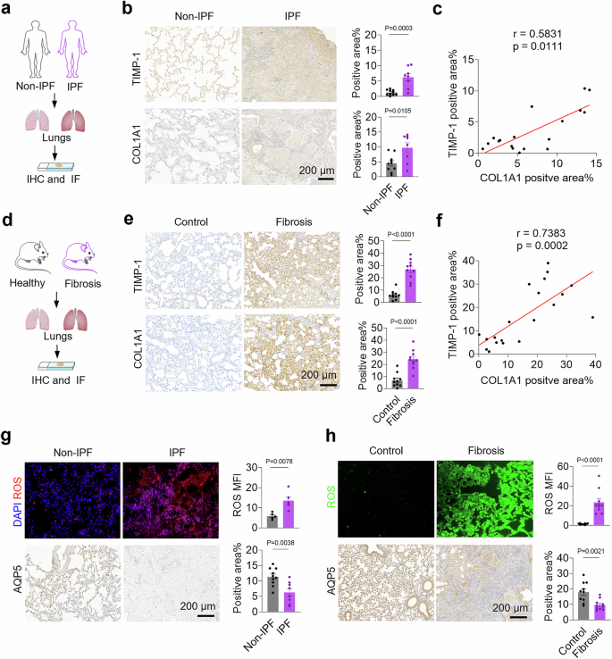 Fig. 2: Correlation of TIMP-1, COL1A1, ROS and AQP5.