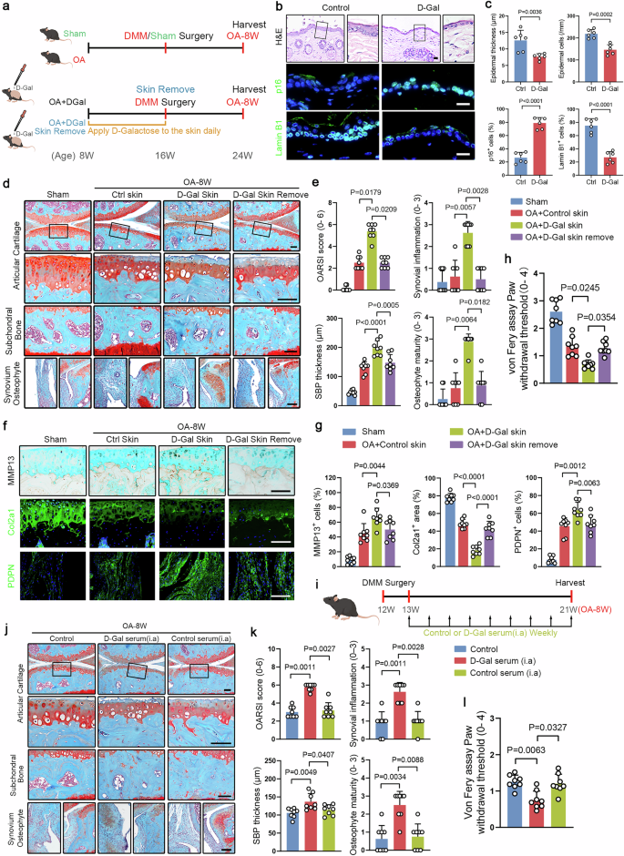 Fig. 1: Premature skin aging promotes traumatic osteoarthritis (OA) progression in mice.