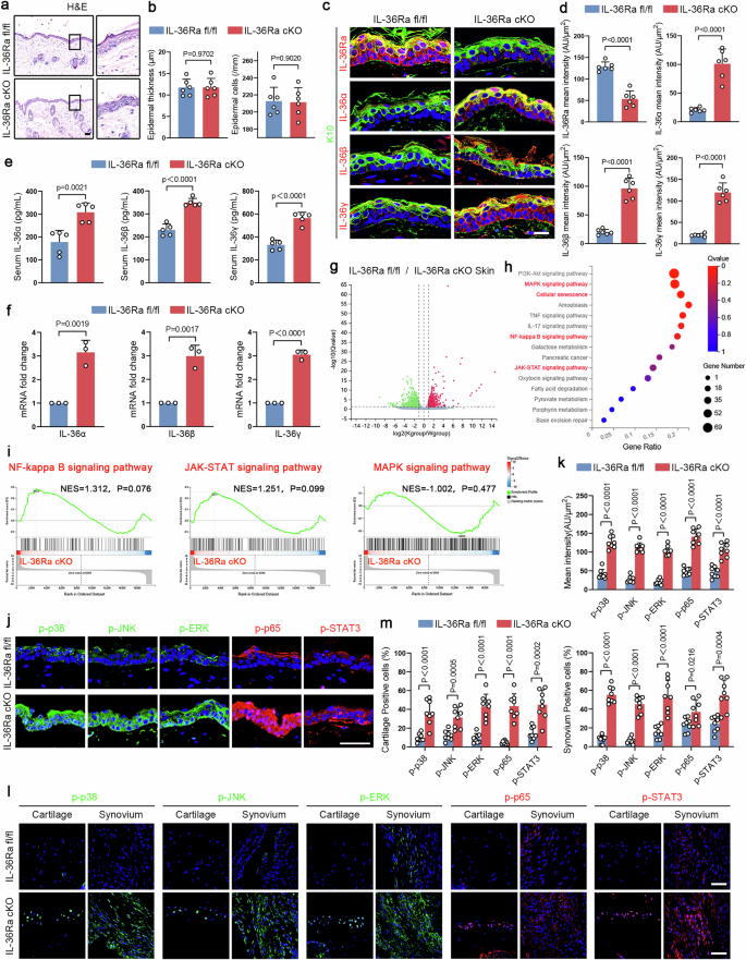 Fig. 3: IL-36Ra deletion in the epidermis keratinocytes activates proinflammatory signaling in vivo.