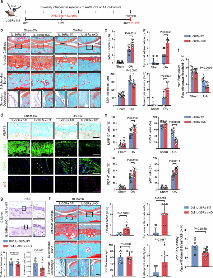 Fig. 4: IL-36Ra ablation in the epidermis keratinocytes aggravates experimental and age-related OA development in mice.