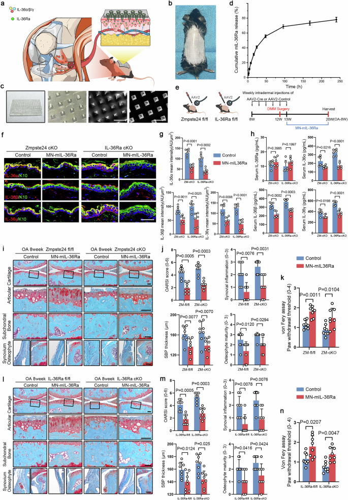 Fig. 6: Inserting microneedles loaded with mIL-36Ra into the skin attenuates experimental OA in mice.