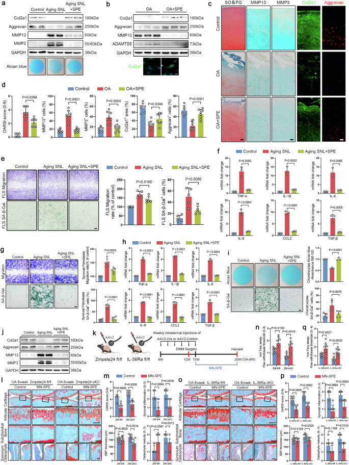 Fig. 7: Spesolimab shows potential therapeutic efficiency for human OA and attenuates experimental OA in mice via microneedle delivery.
