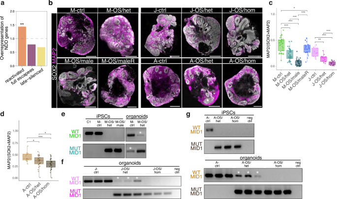Fig. 5: X-reactivation impacts on phenotype dimorphism of OS.