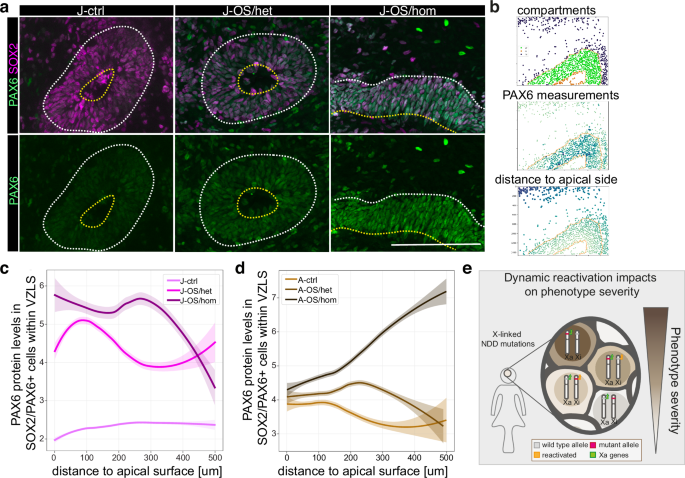 Fig. 6: The MID1 target PAX6 correlates with OS phenotype attenuation.