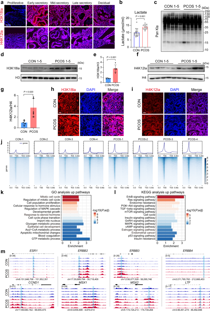 Fig. 2: PCOS endometrium shows elevated Kla.