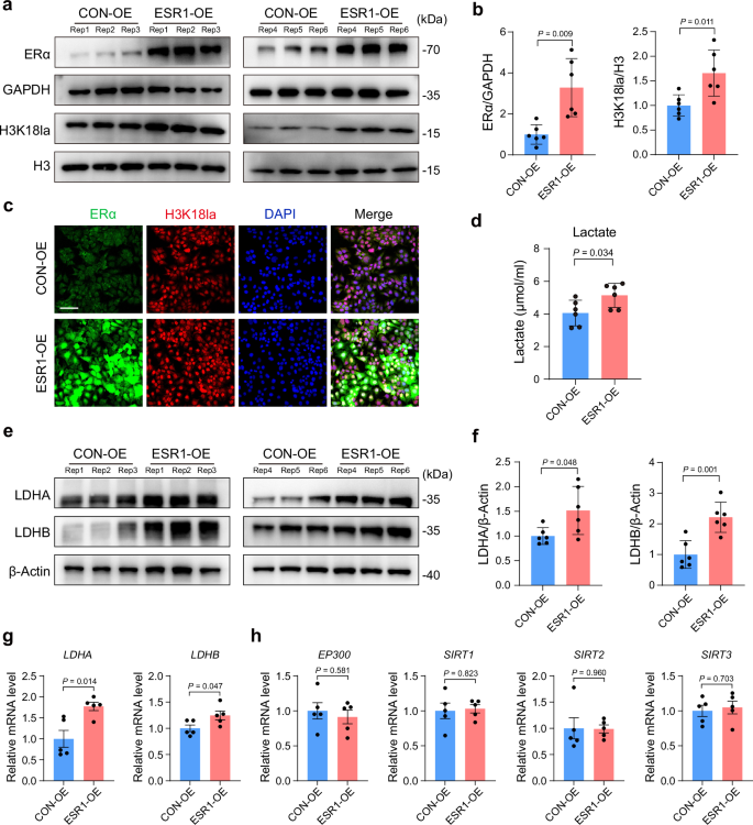 Fig. 3: ERα overexpression upregulates Kla in Ishikawa cells.