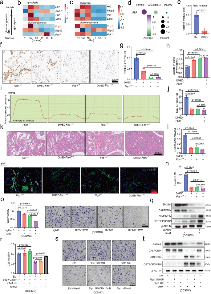 Fig. 2: Fbp1 is a key factor for cavernosal lactate accumulation in DMED.