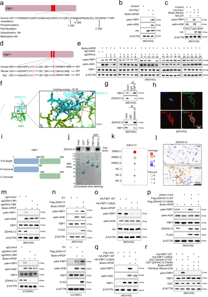 Fig. 5: ZDHHC13 mediated S-palmitoylation of FBP1 at C282 site.