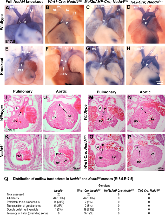Fig. 1: Nedd4 activity in neural crest cells is required for cardiac outflow tract development.