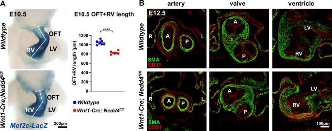 Fig. 2: Hearts of Wnt1-Cre; Nedd4fl/fl embryos exhibit shortened outflow tract and incomplete outflow tract rotation.