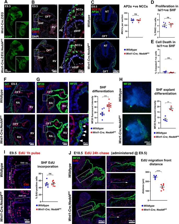 Fig. 3: Wnt1-Cre; Nedd4fl/fl embryos display precocious differentiation and defective deployment of anterior second heart field derivatives.