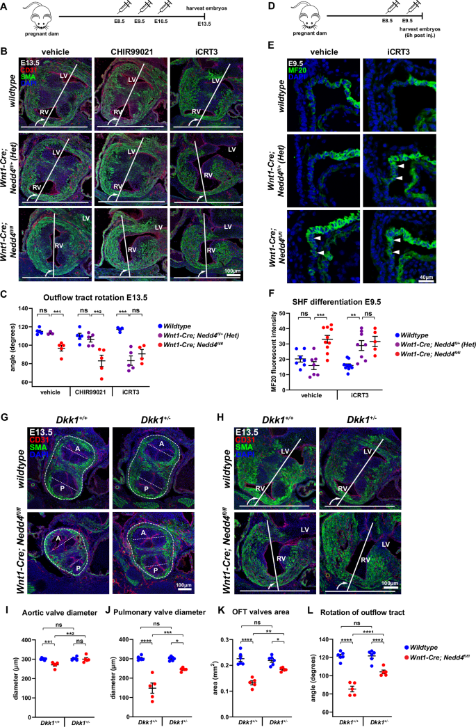 Fig. 5: Reduced canonical Wnt signalling underpins precocious second heart field differentiation.