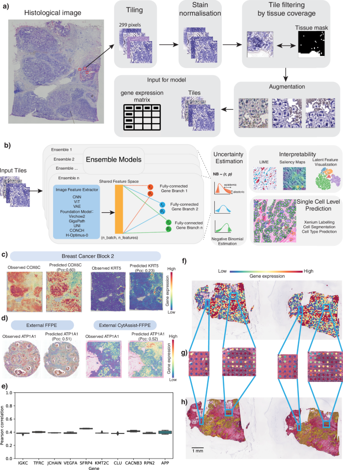 Fig. 1: Overview of the robust and interpretable STimage model.