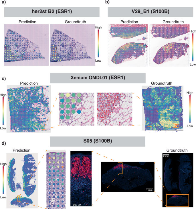 Fig. 3: Out-of-distribution assessment of model training on Visium breast cancer data and a functional gene list of 1522 genes, with predictions across various datasets and cancer types using different spatial technologies.