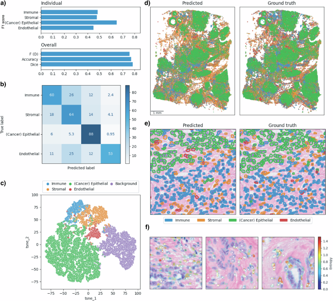 Fig. 4: Cell type classification at single-cell resolution using a customised Hover-Net model on Xenium data.