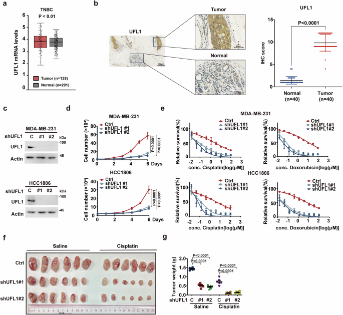 Fig. 1: UFL1 exerts an oncogenic role in TNBC.