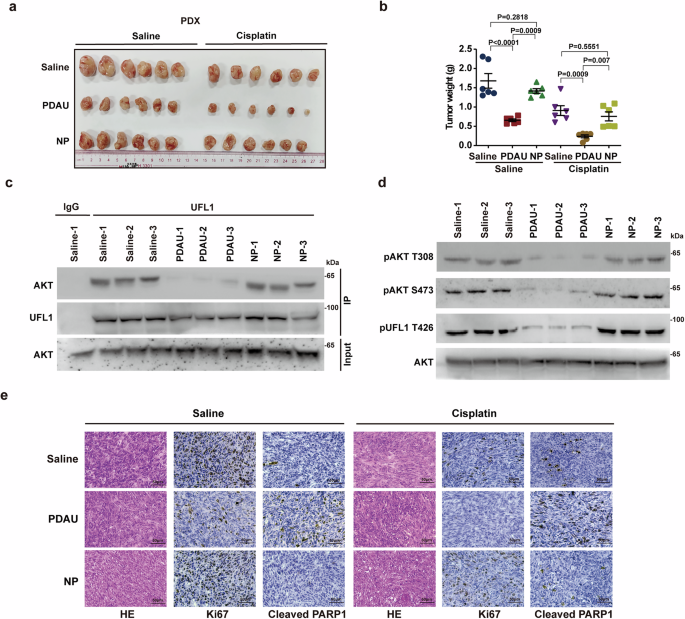 Fig. 7: Disrupting the UFL1-AKT1 interaction by PDAU suppresses TNBC progression in vivo.