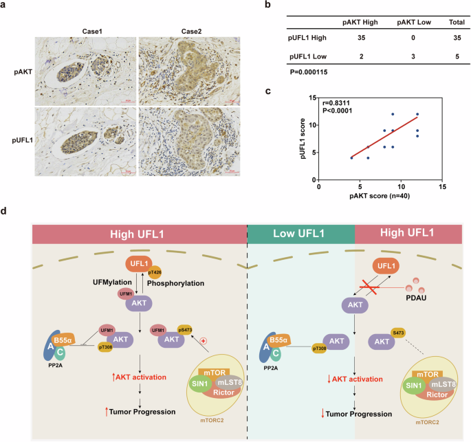 Fig. 8: Correlations between pUFL1 and pAKT expression in TNBC.