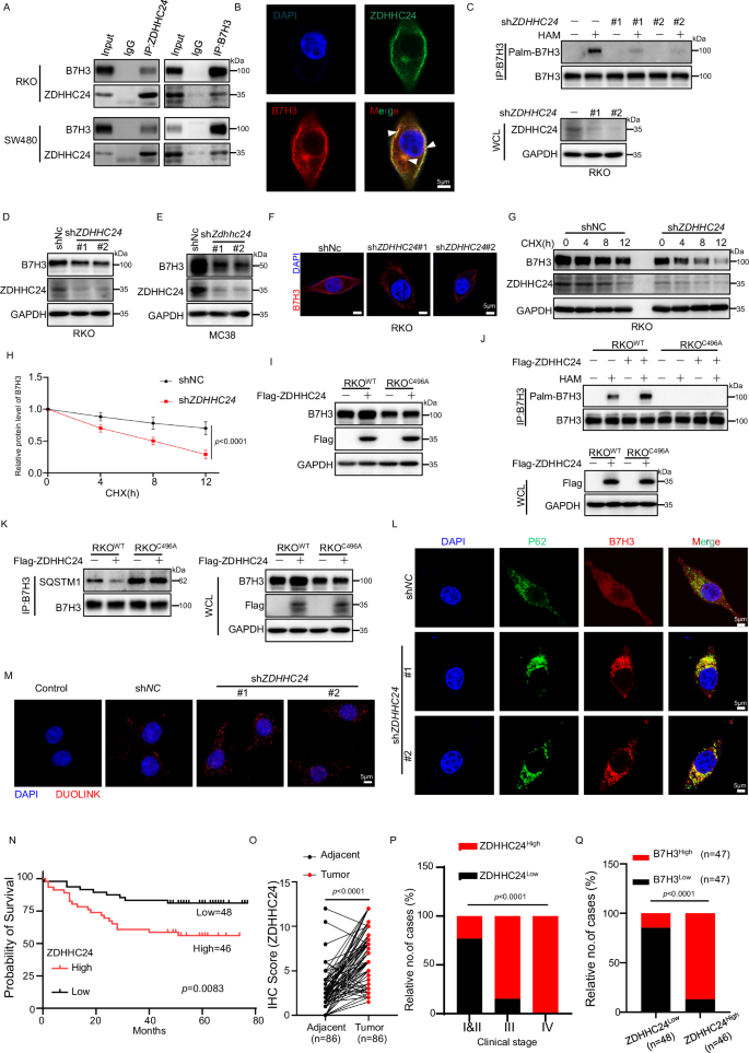 Fig. 4: ZDHHC24-mediated B7H3 palmitoylation promotes protein stability and is linked to poor colorectal cancer outcomes.