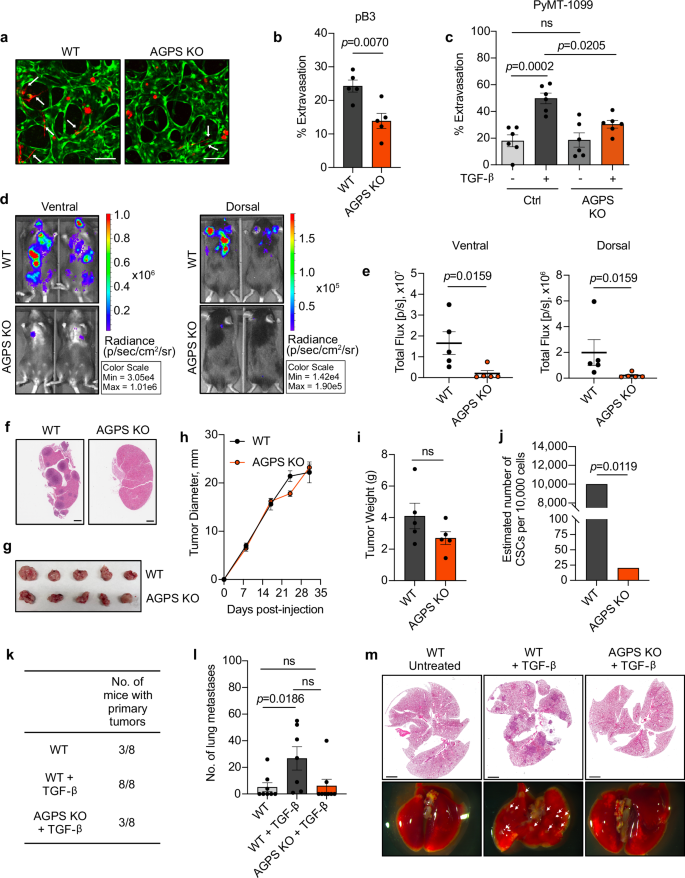 Fig. 5: Loss of ether lipids decreases metastasis and cancer cell stemness.