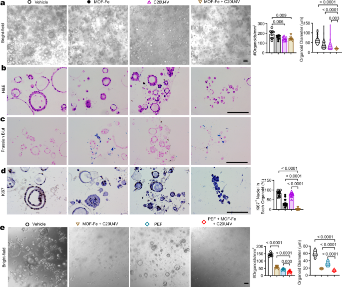 Fig. 6: C20U4V augmented MOF-Fe-induced ferroptosis and enhanced the efficacy of PEF against patient-derived organoids.