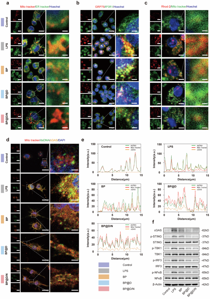 Fig. 5: Camouflaged nanorobots inhibit the pathological formation of MAMs and mtDNA leakage in Mφ.