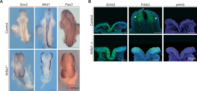 Fig. 3: Nr6a1 is required for the transition from neural stem to NCC.
