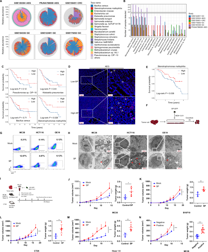 Fig. 1: SP is an intracellular bacterium within tumor cell and is associated with tumor progression in GIT.