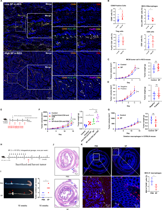 Fig. 2: SP impairing macrophage function in TME.