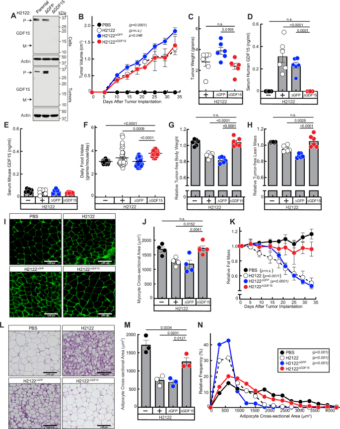Fig. 6: GDF15 silencing in STK11/LKB1-mutated NSCLC tumors xenotransplanted into mice that have low circulating GDF15 concentrations.