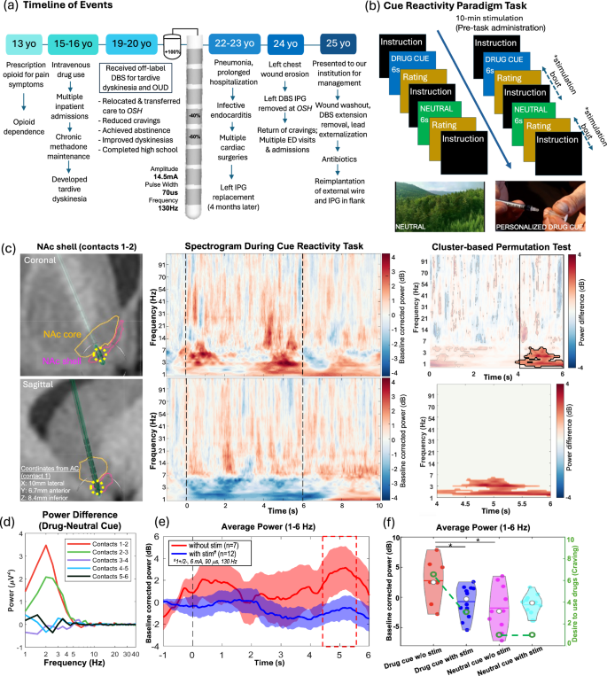 Fig. 1: A specific 1–6 Hz low-frequency electrophysiological biomarker can be identified with a personalized cue-reactivity paradigm task.