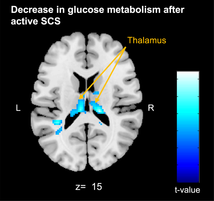 Fig. 4: Metabolic changes.