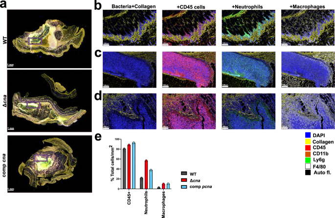 Fig. 3: S. aureus-collagen aggregates influence neutrophilic response in skin abscess infection.