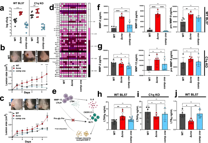 Fig. 5: C1q-Cna binding controls matrix metalloprotease activity and inflammation in skin abscess.