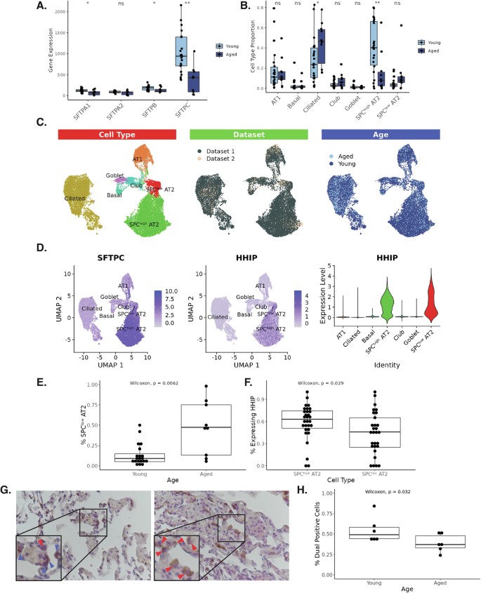 Fig. 3: Age-associated changes in alveolar microenvironment.