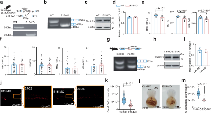Fig. 4: Exon 15 of TBC1D23 regulates erythropoiesis in mice and zebrafish.