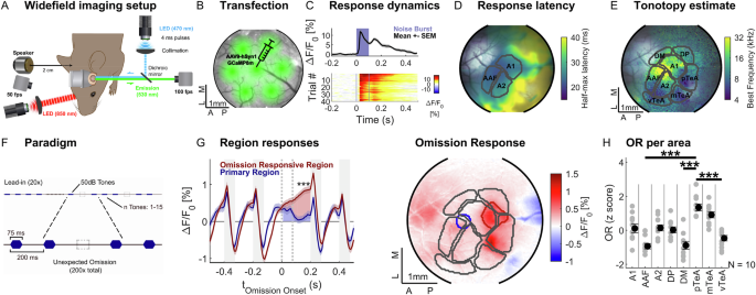 Fig. 1: Auditory omission responses consistently localize to the temporal association area.
