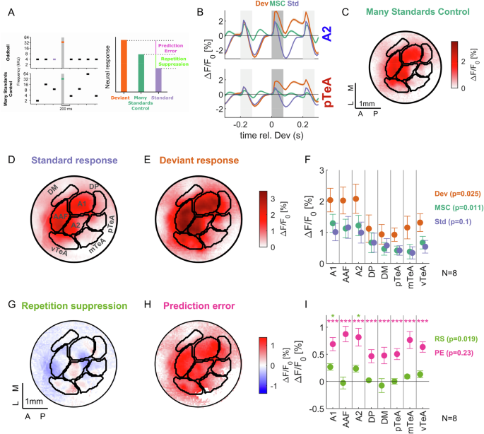 Fig. 7: Omission responses localize to different areas than repetition suppression.