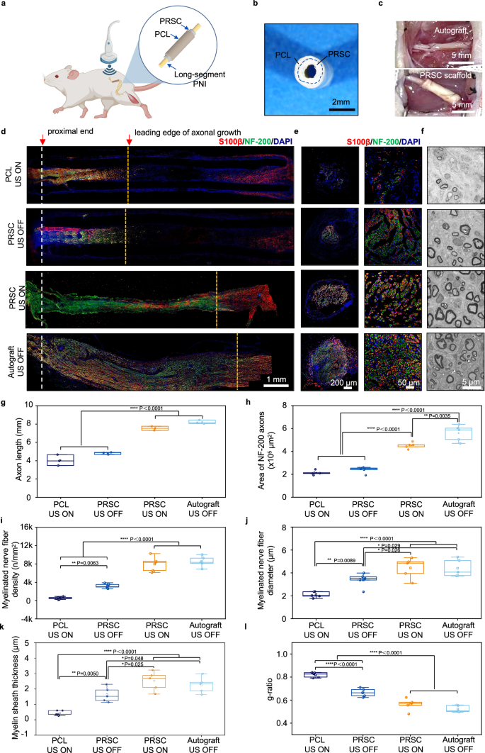 Fig. 4: PRSC promotes sciatic nerve regeneration under ultrasound stimulation.
