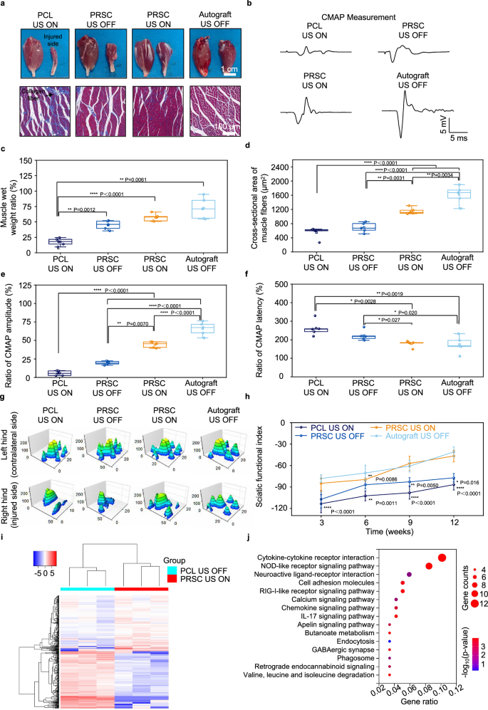 Fig. 5: PRSC promotes motor function recovery of injured sciatic nerves at 12 weeks postimplantation under ultrasound stimulation.