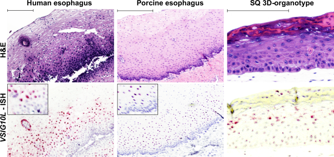 Fig. 1: Localization of VSIG10L in esophageal squamous mucosa.